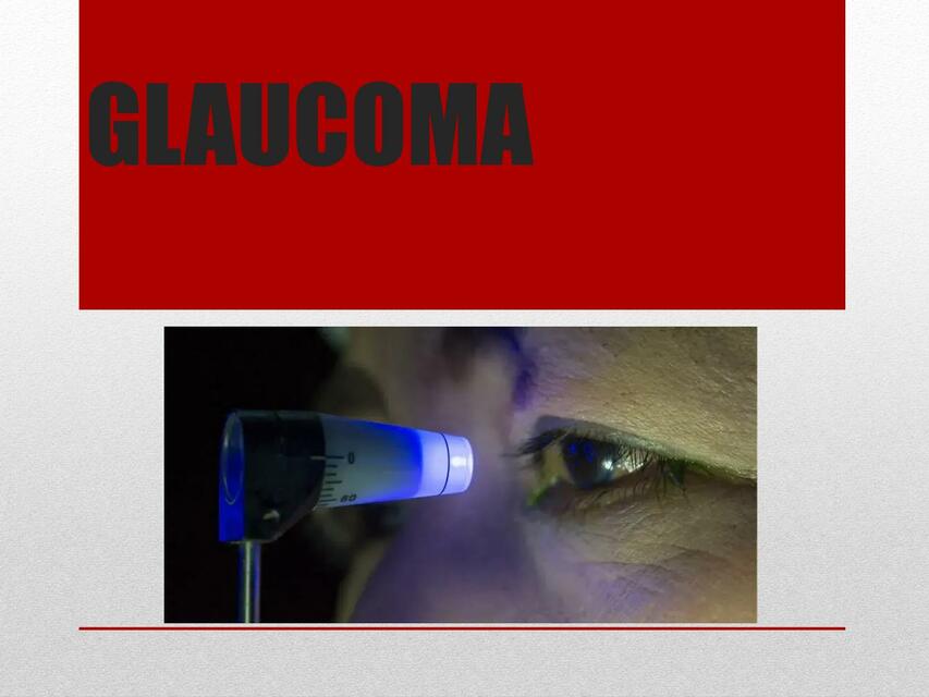 GLAUCOMA