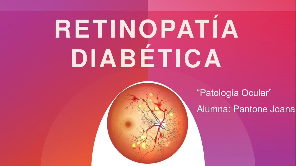 Presentación de Retinopatía Diabética