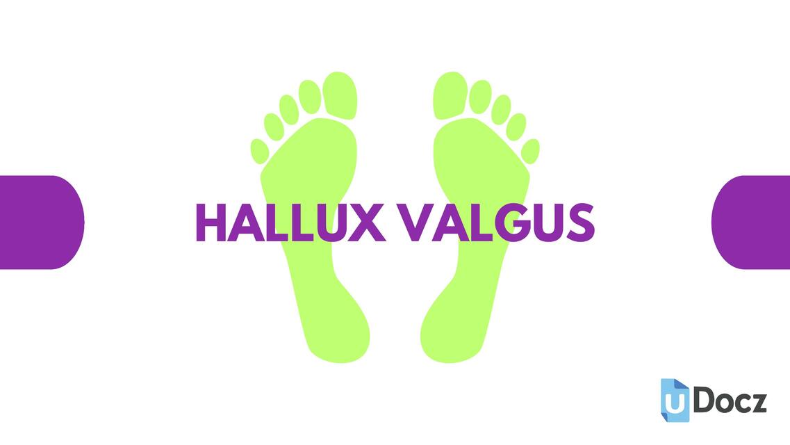 HALLUX VALGUS