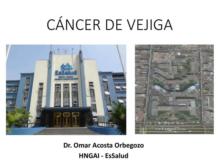 Clase 08 Cáncer de Vejiga