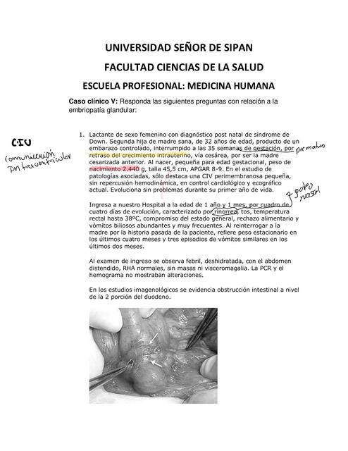 Caso clínico embriopatía glandular