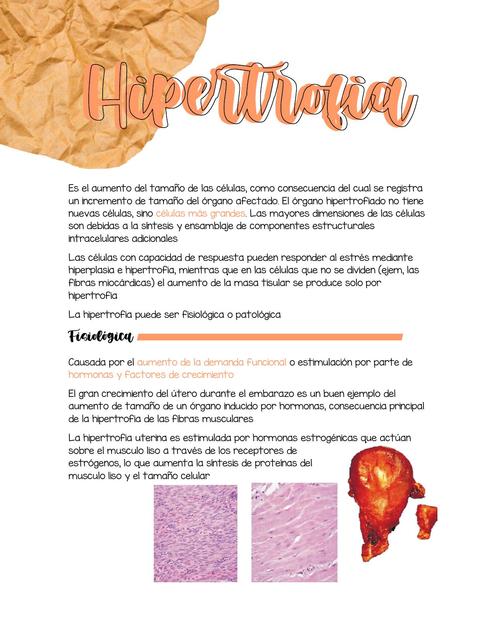 Patología de Hipertrofia Robbins