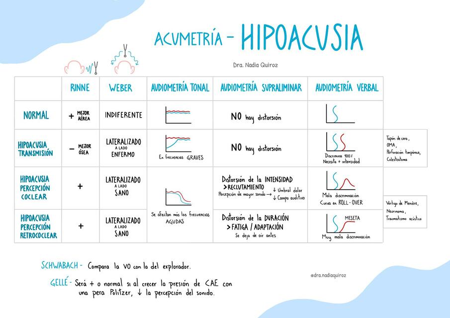 Acumetría - hipoacusia