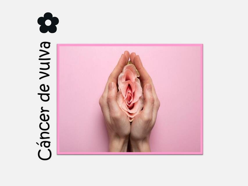 Cancer de Vulva