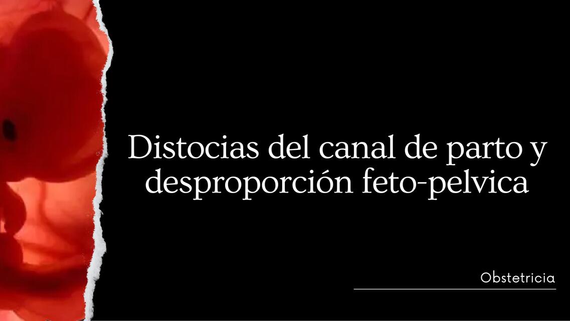 Distocias del canal de parto y desproporción feto pélvica  