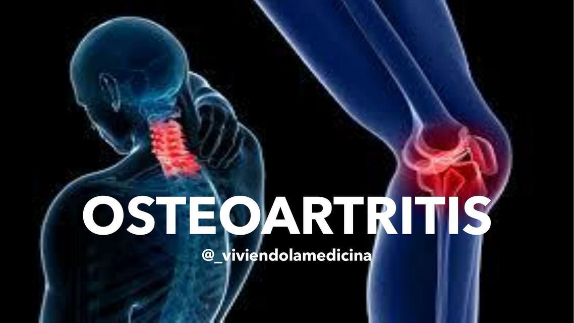 Osteoartritis | Viviendo la medicina | uDocz