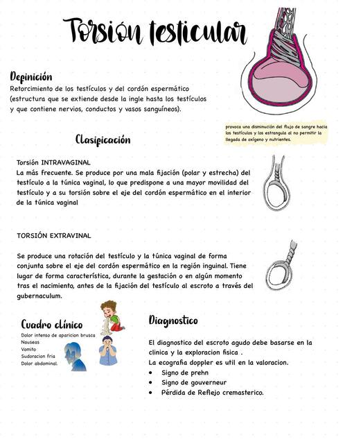 Torsión testicular