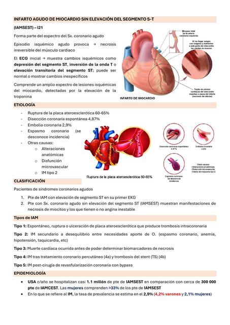 INFARTO AGUDO DE MIOCARDIO SIN ELEVACIÓN DEL SEGMENTO S-T