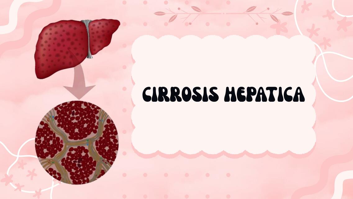 CIRROSIS HEPATICA