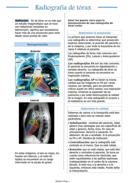 Radiografía de tórax