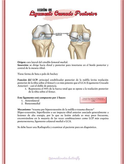 LESIÓN LIGAMENTO CRUZADO POSTERIOR