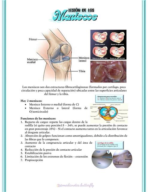 LESIÓN DE LOS MENISCOS