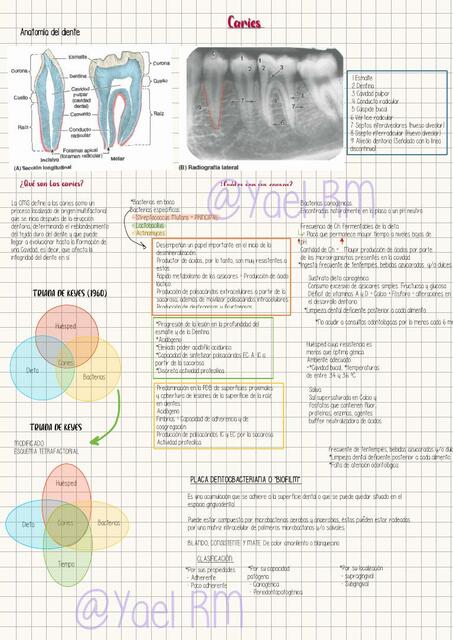 Caries