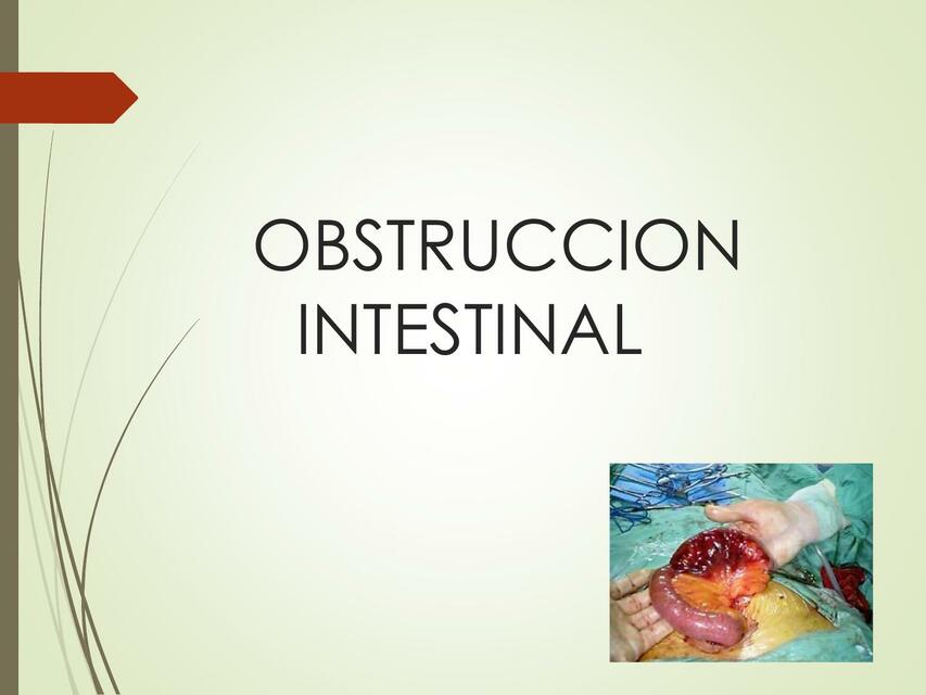 obstrucción intestinal