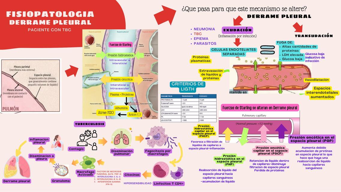 DERRAME PLEURAL EXUDADO