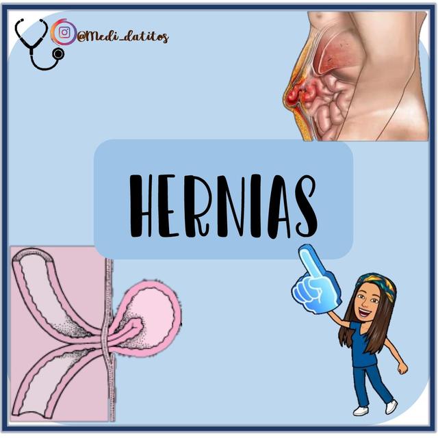 HERNIAS