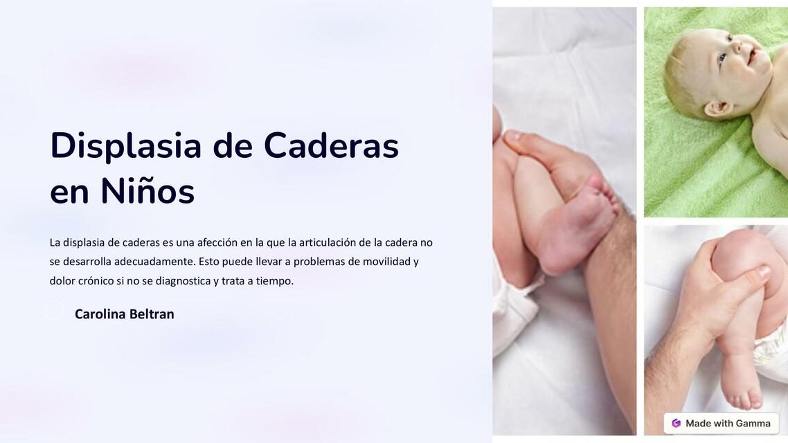 Displasia de cadera 