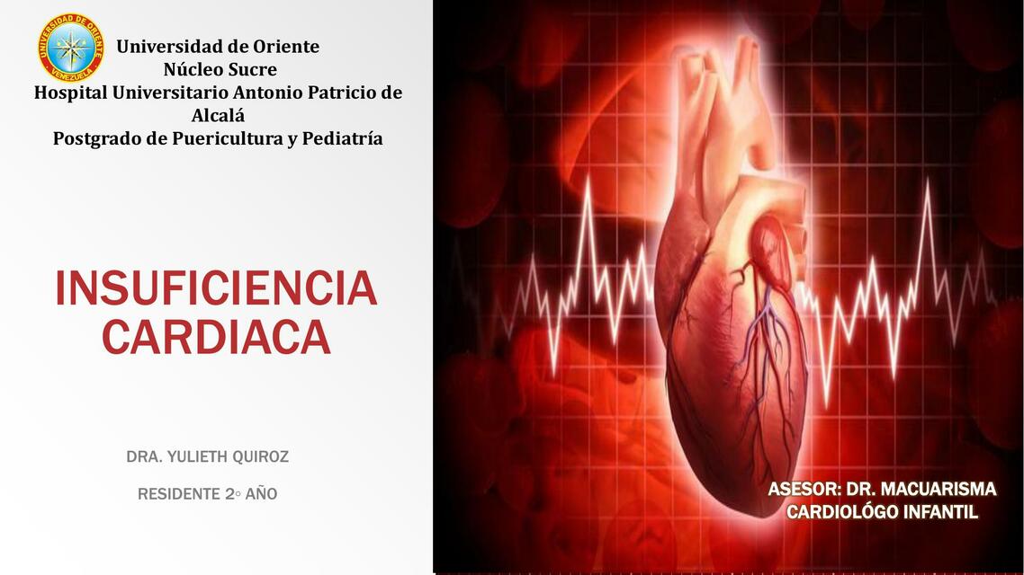 Insuficiencia cardiaca 