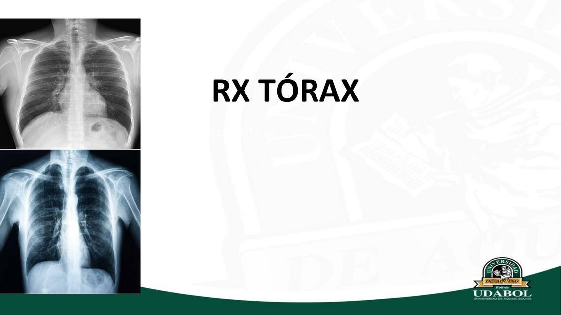 RX TÓRAX