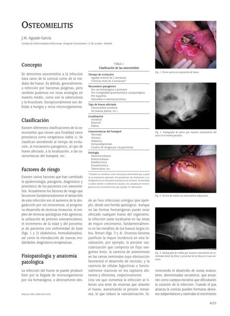 Infecciones: OSTEOMIELITIS