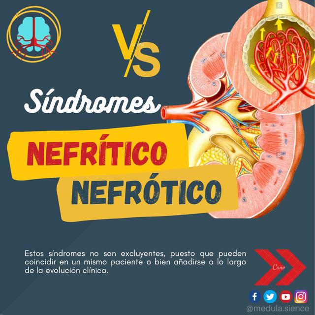 Sindrome Nefritico y Nefrotico