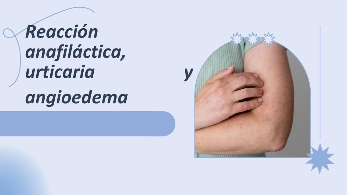 URTICARIA Y ANGIOEDEMA EN PEDIATRIA