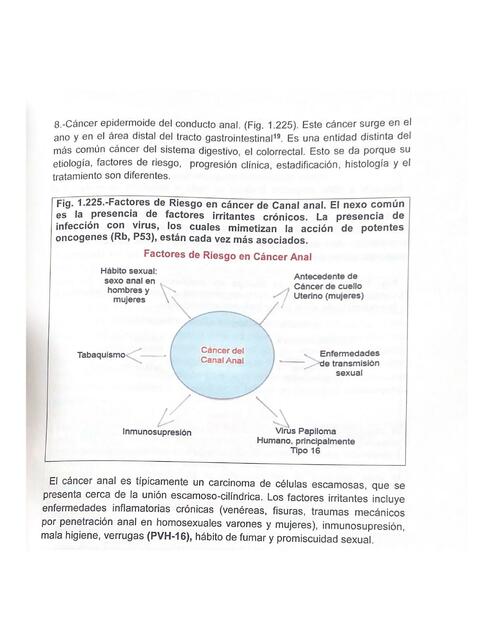 Cáncer epidermoide del conducto anal 