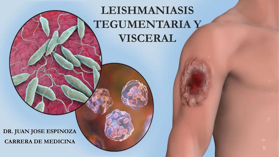 LEISHMANIASIS TEGUMENTARIA Y VISCERAL