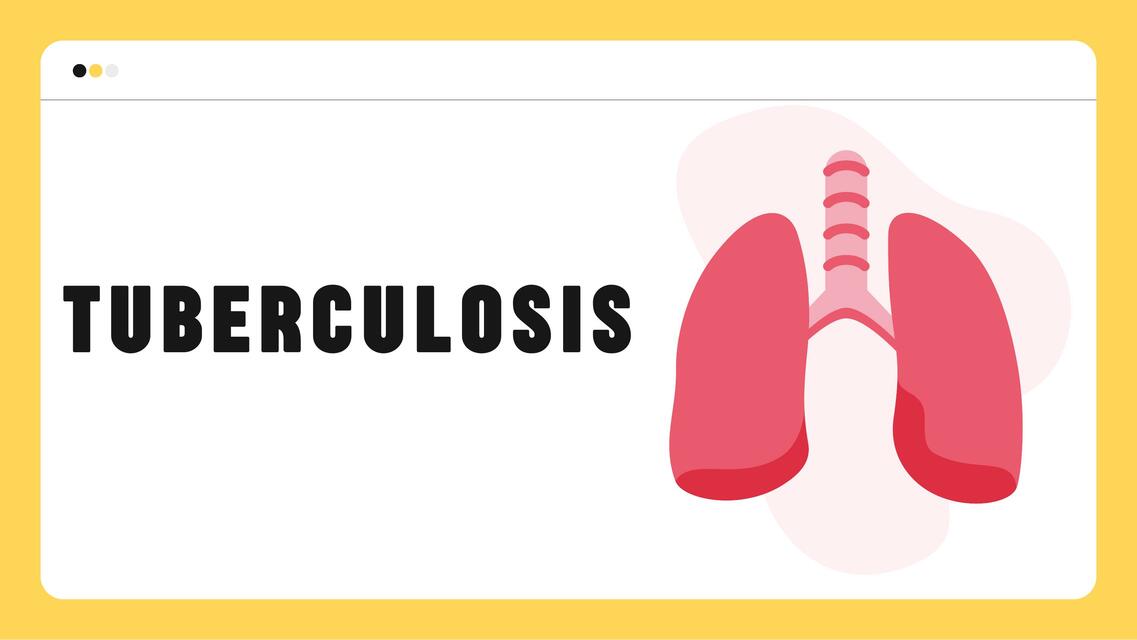 TUBERCULOSIS