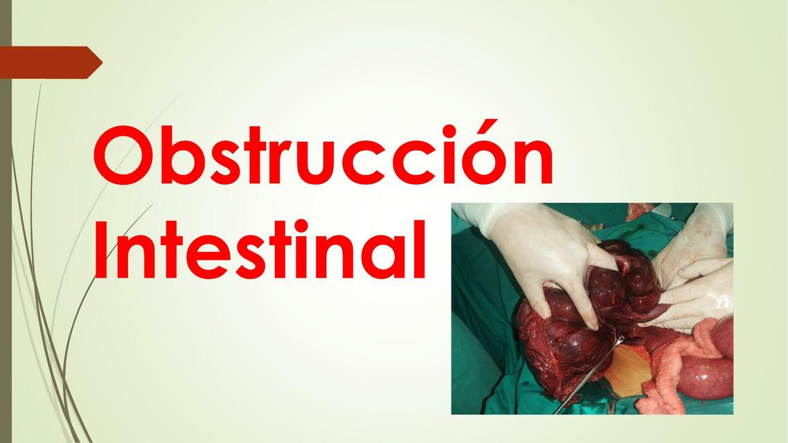 Obstrucción intestinal