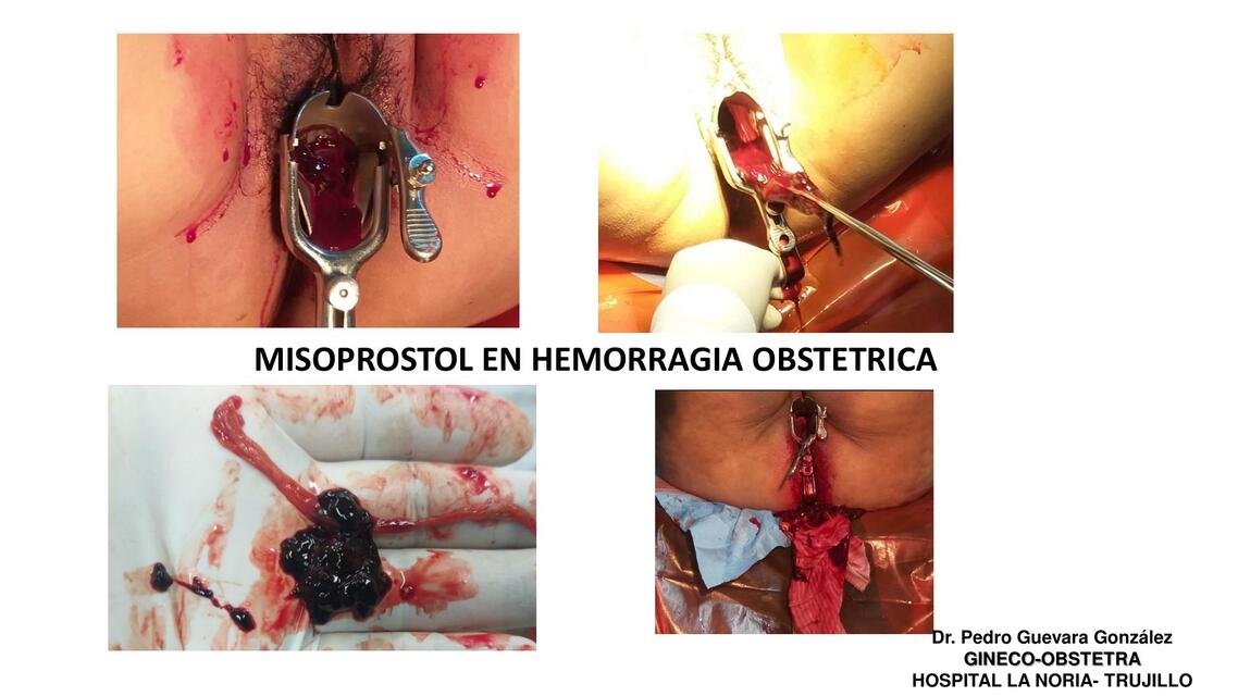 8 MISOPROSTOL en Clave Roja pptx