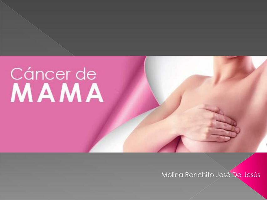 Cáncer de mama