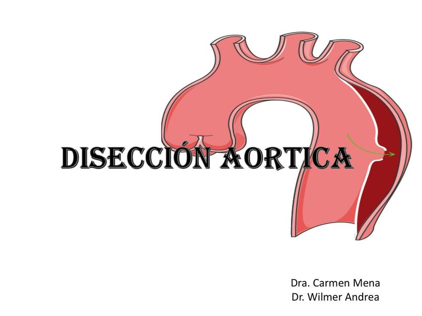 diseccion aorticaa