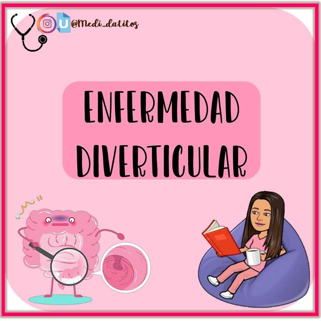 RESUMEN - ENFERMEDAD DIVERTICULAR