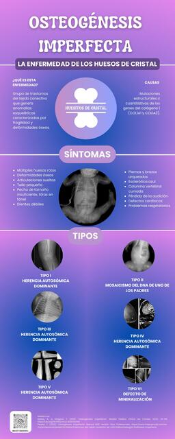 Osteogénesis Imperfecta