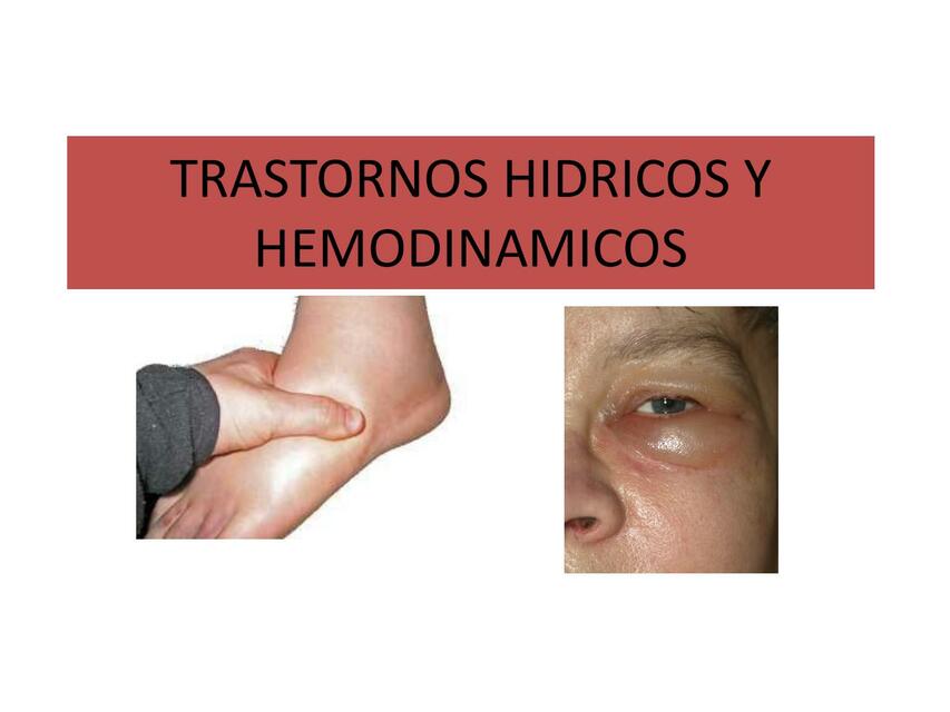 TRASTORNOS HIDRICOS