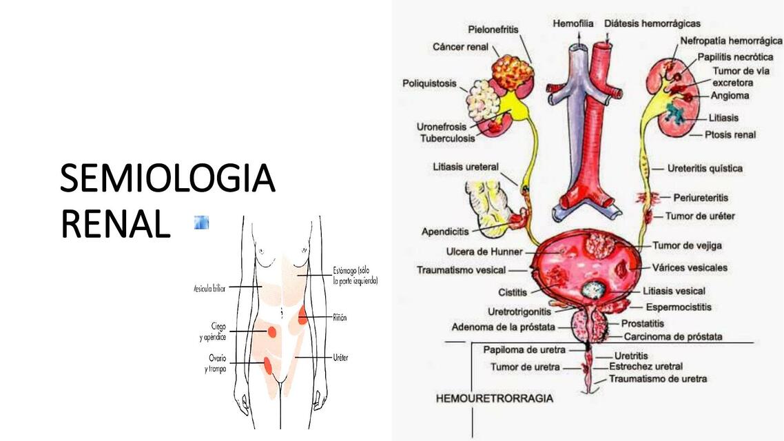 Semiologia renal