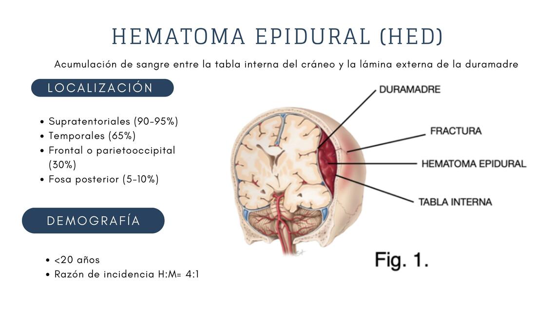 HEMATOMA EPIDURAL Y SUBDURAL AGUDO