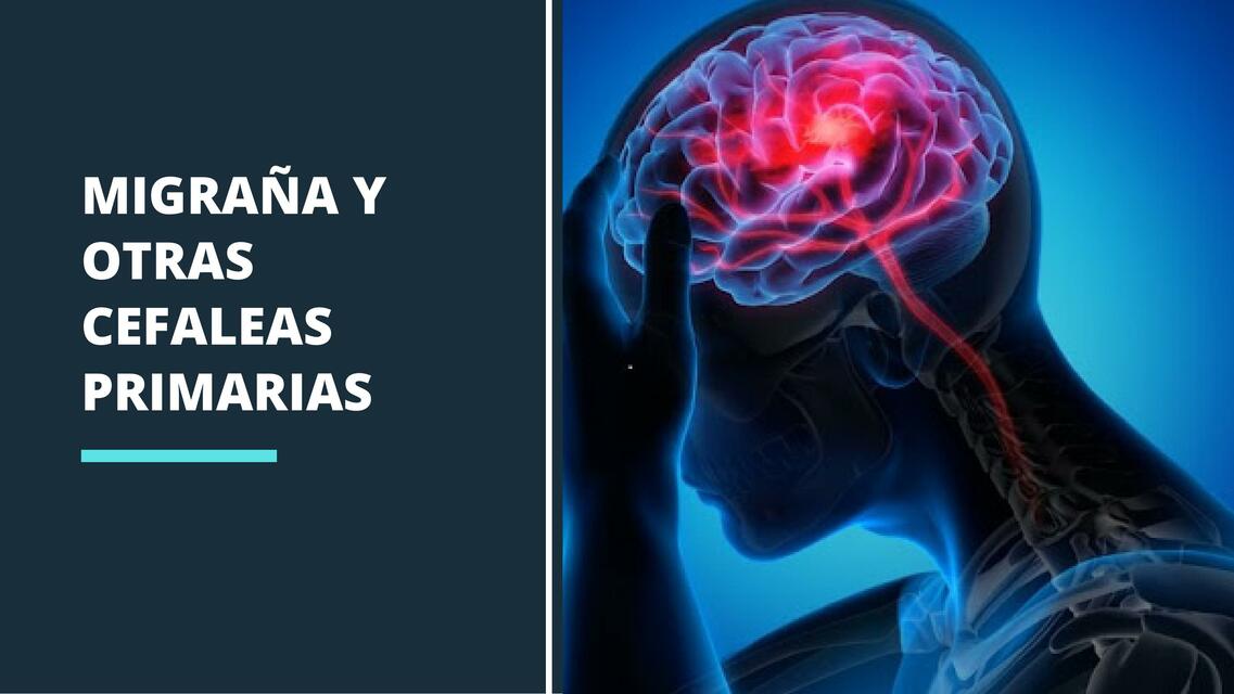 MIGRAÑAS Y CEFALEAS PRIMARIAS