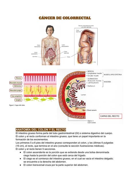 CÁNCER DE COLON Y RECTO