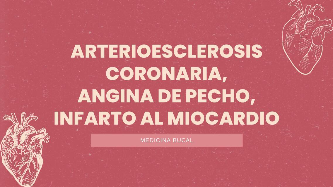 Ateroesclerosis coronaria, Angina de pecho e infarto