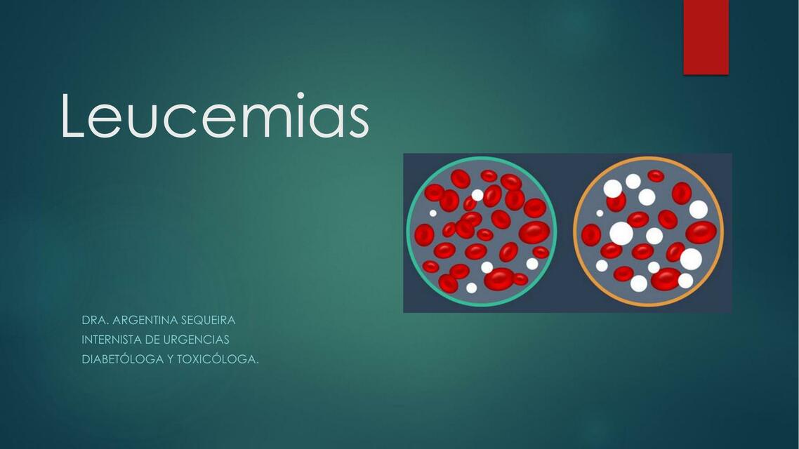 Leucemias