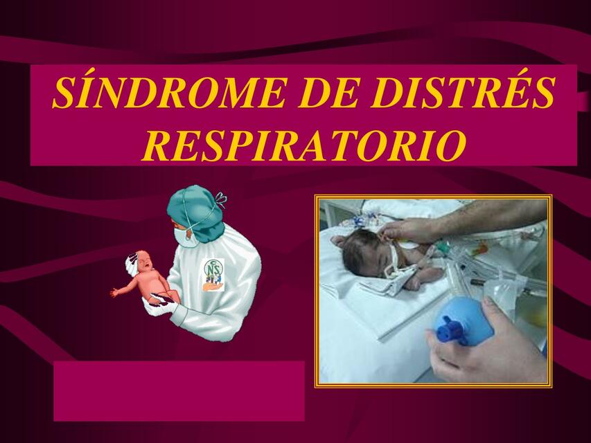 SINDROME DE DISTRES RESPIRATORIO