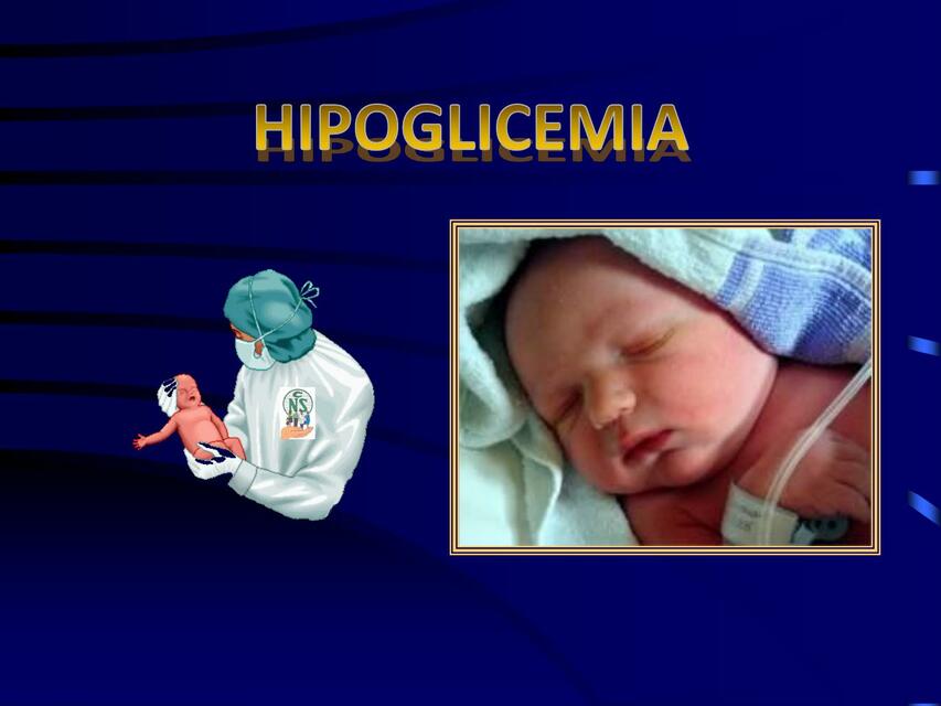 HIPOGLUCEMIA