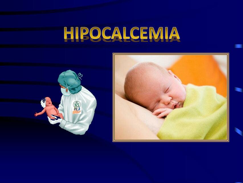 HIPOCALCEMIA