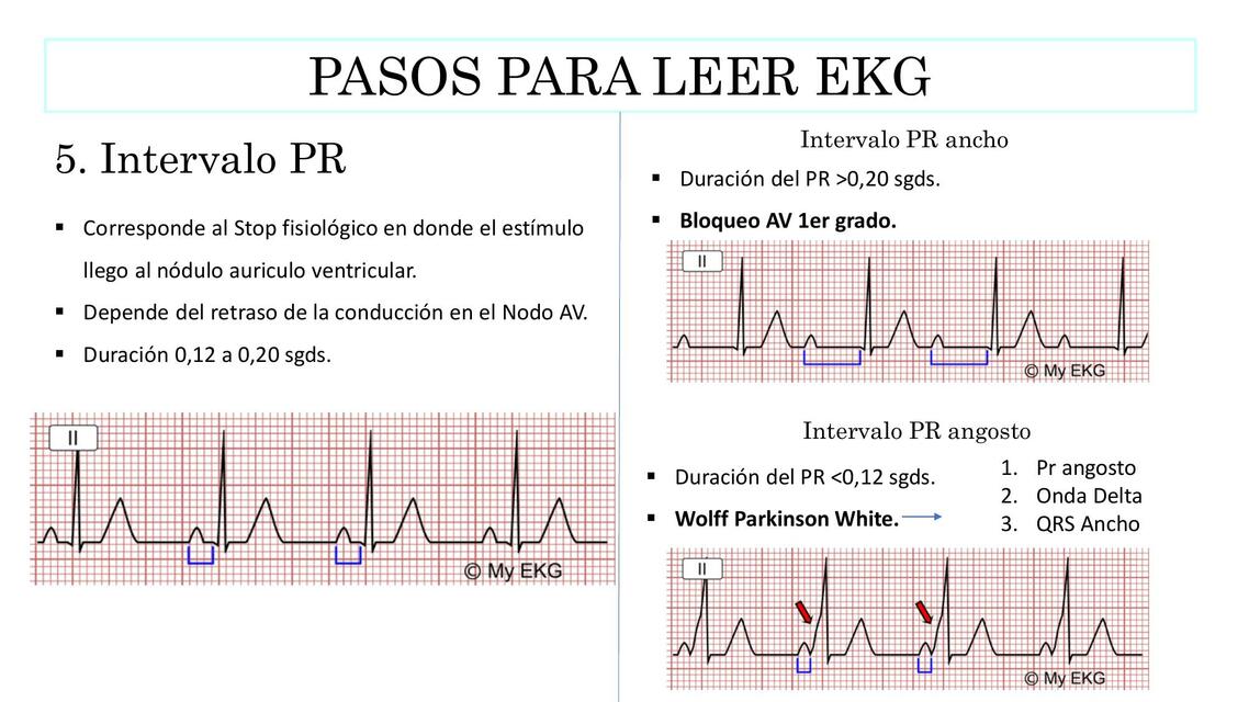 INTERVALO PR EKG | Doctor_teco | uDocz