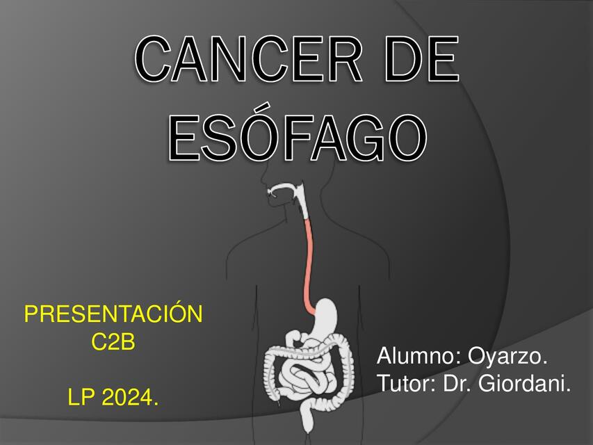 CANCER DE ESÓFAGO