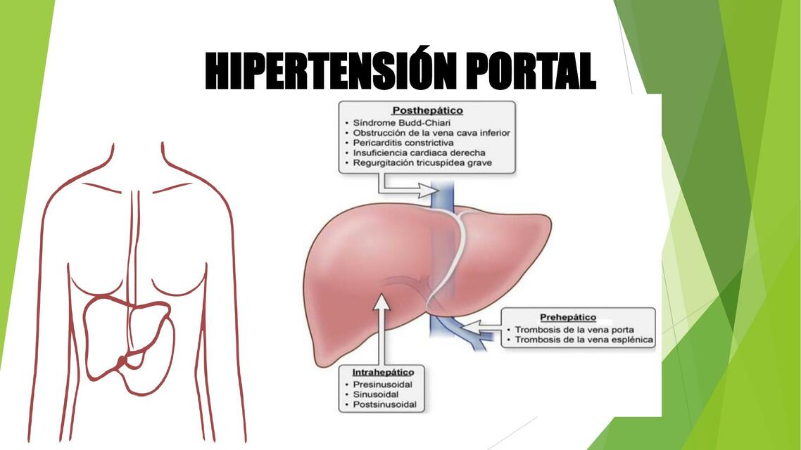 HIPERTENSION PORTAL