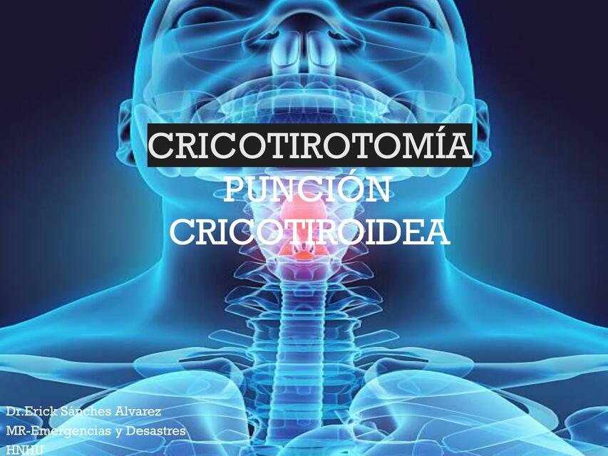 Cricotiro