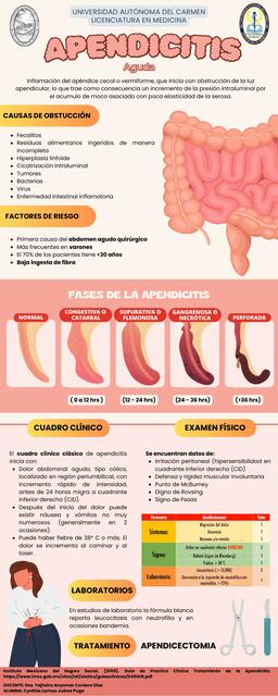 APENDICITIS AGUDA